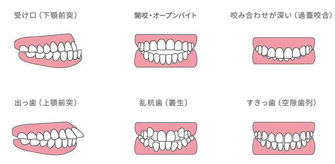 どんな歯並びの症状にも対応できる